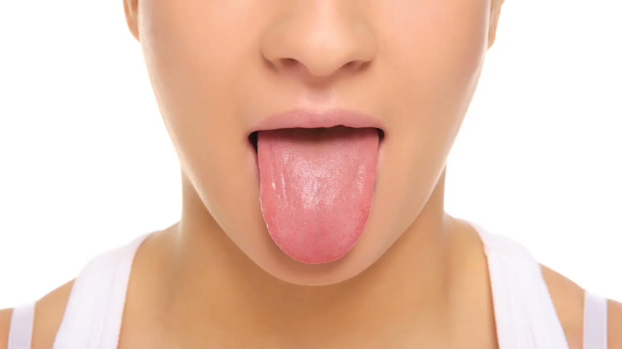 inflamacion de las papilas de la lengua