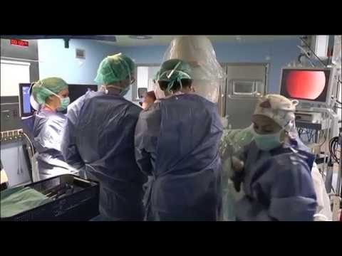 intervenciones quirúrgicas grupo 0 1 y 2