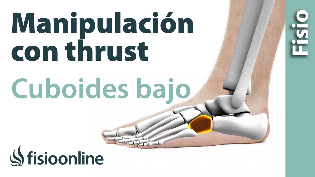 me duele mucho el cuboides del pie