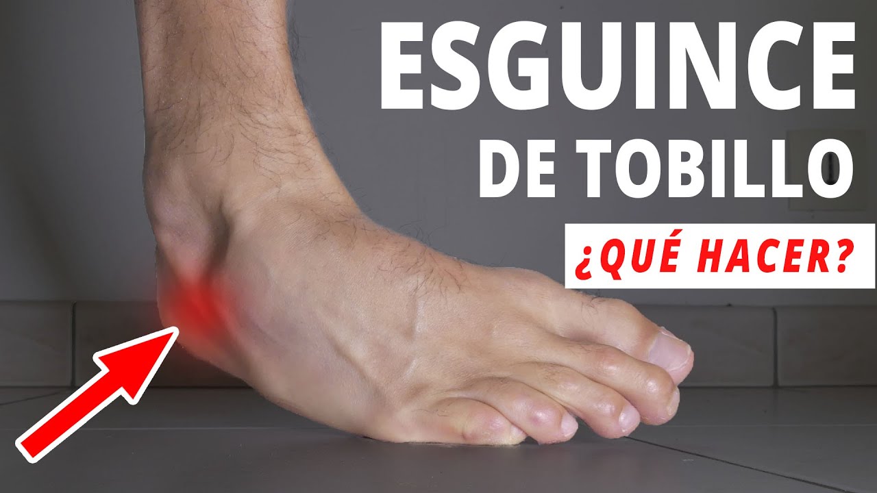 mejor crema para esguince de tobillo