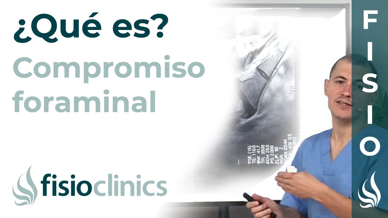 mejor especialista columna palma de mallorca