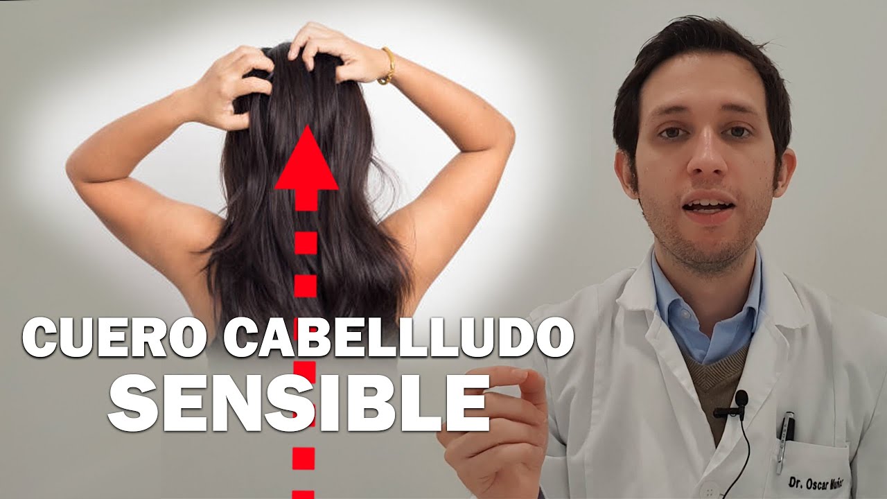 picor cuero cabelludo y caída pelo