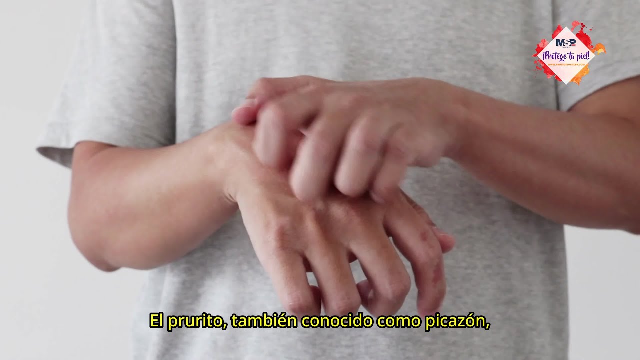 picor en los brazos en verano