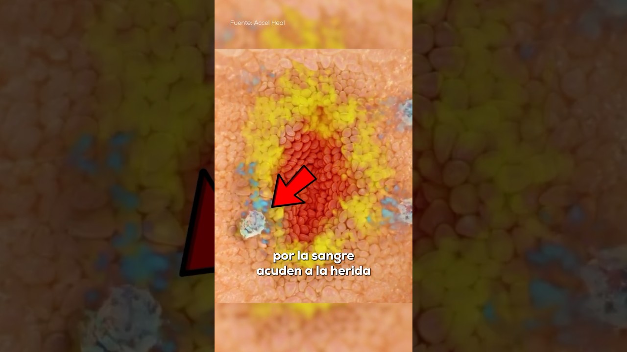 porque se me infectan todas las heridas