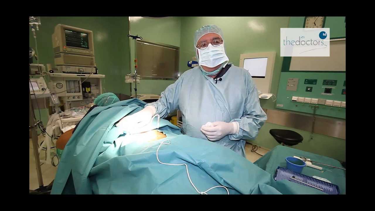 que es la rizolisis por radiofrecuencia
