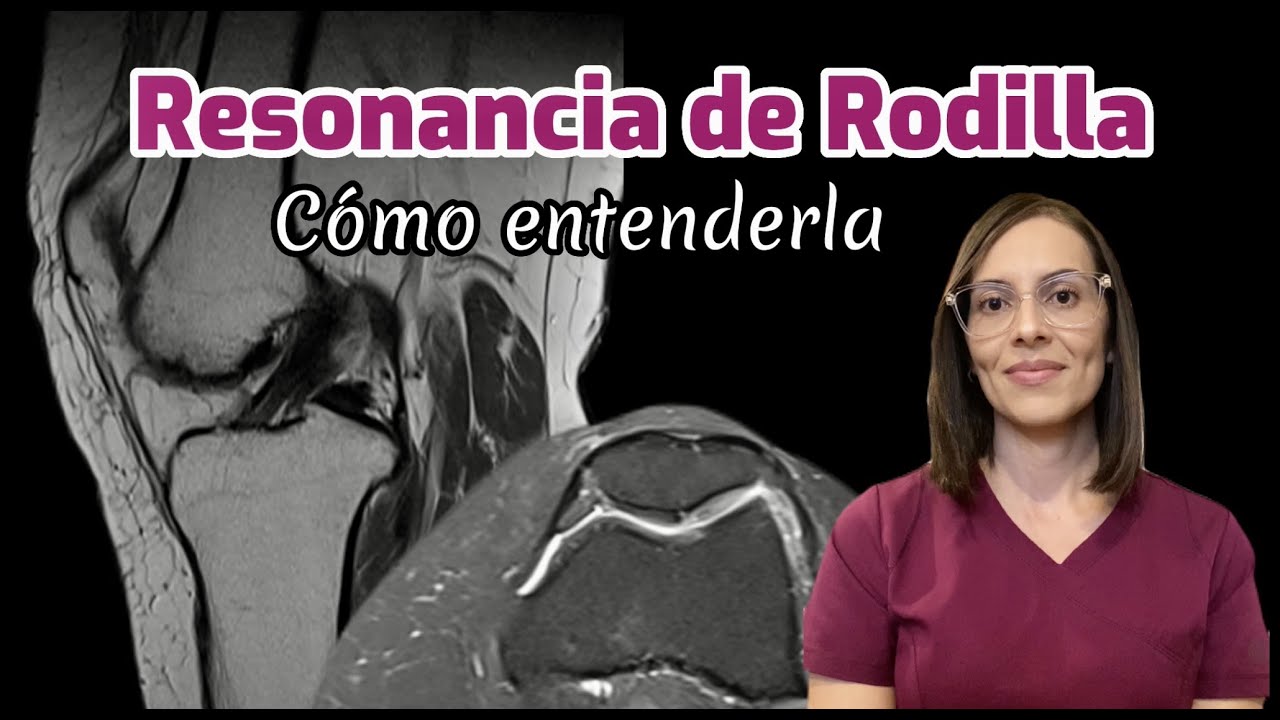 que se ve en una resonancia de rodilla