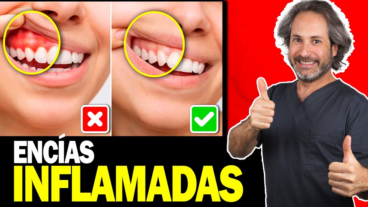 remedios caseros para encias inflamadas por protesis