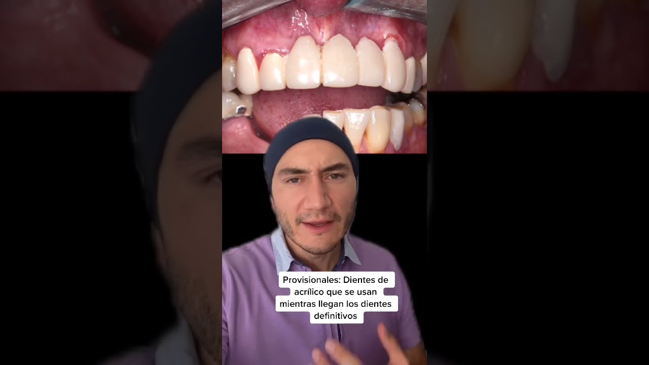 se puede comer con dientes provisionales