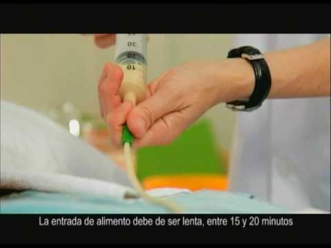 se puede tomar agua con sonda nasogástrica