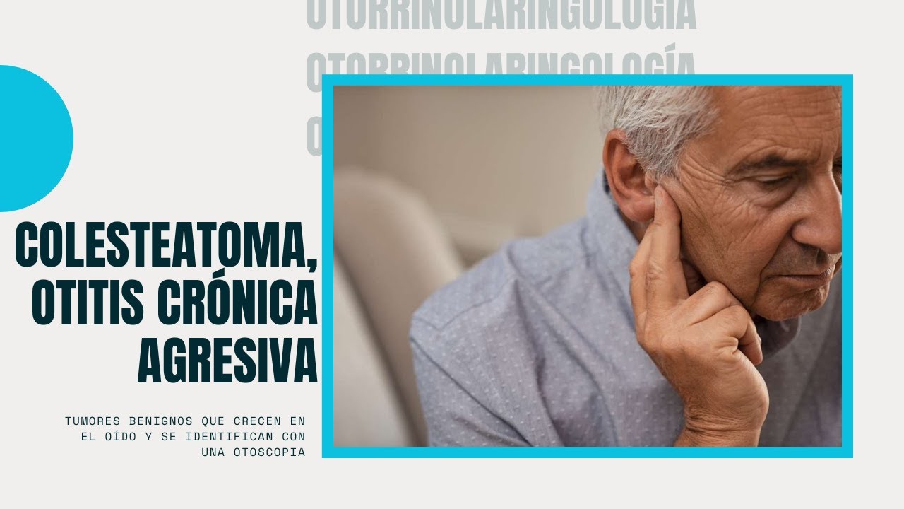 se puede vivir con un colesteatoma