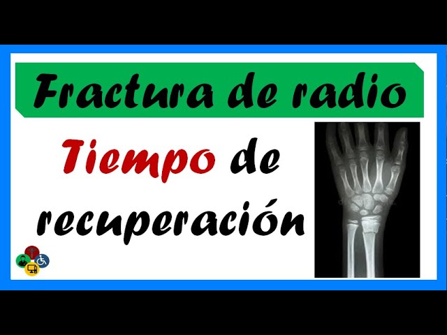 tiempo de baja por fractura de radio distal