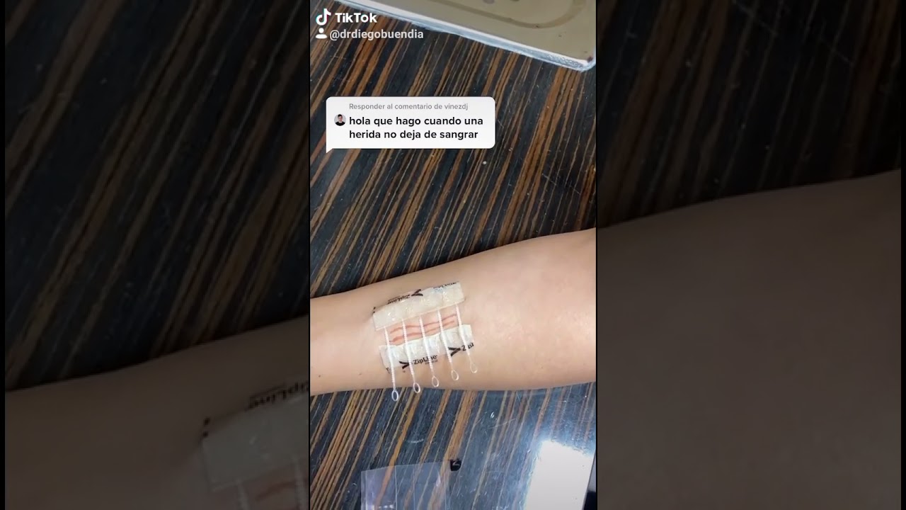 como cerrar una herida que no cierra