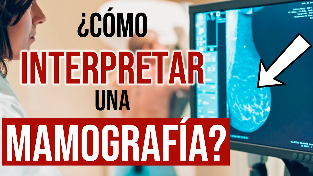 cuanto tardan en darte los resultados de una ecografía