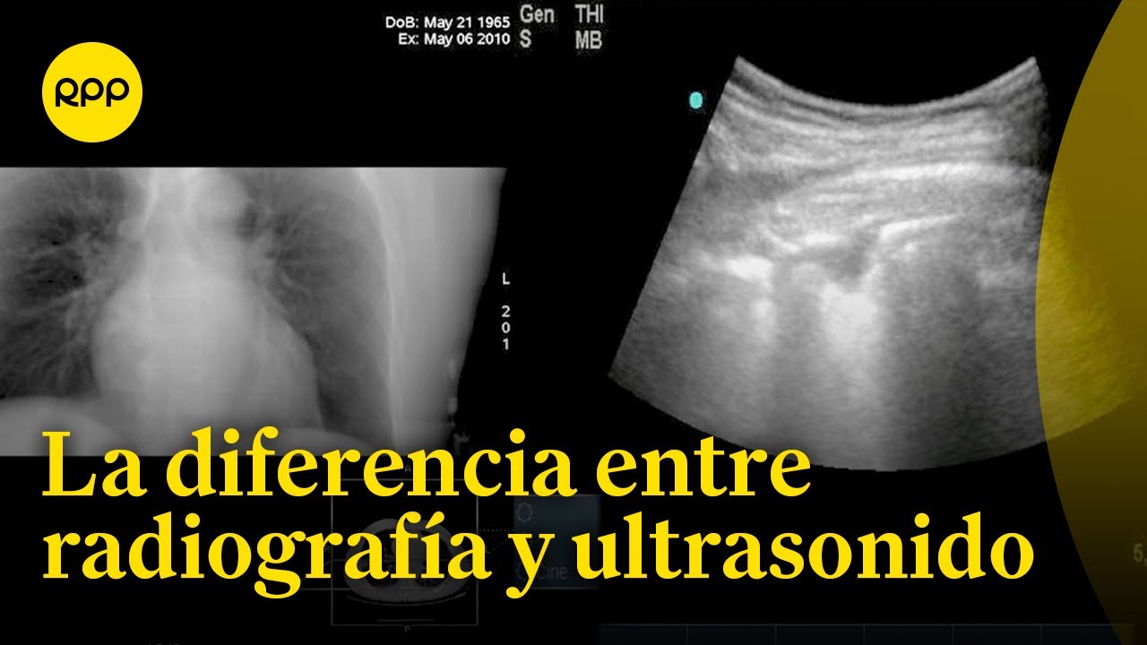 diferencia entre radiografía ecografía y resonancia