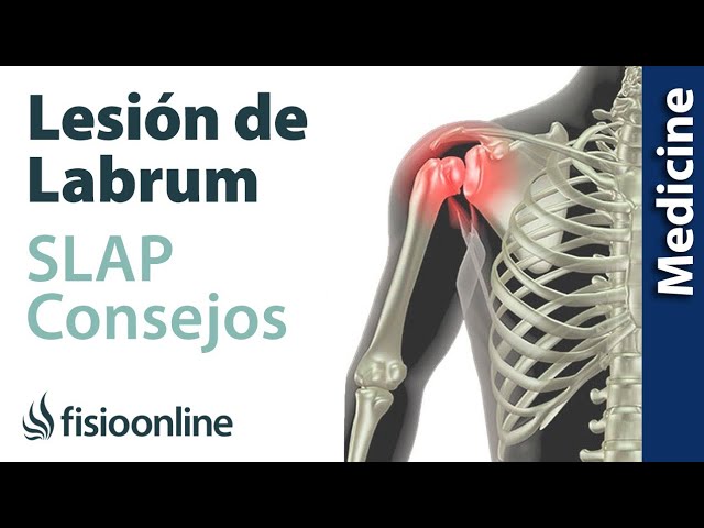 dolor de hombro después de una caída