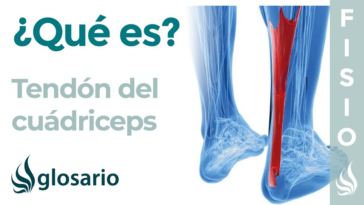 dolor en el tendon del cuadriceps
