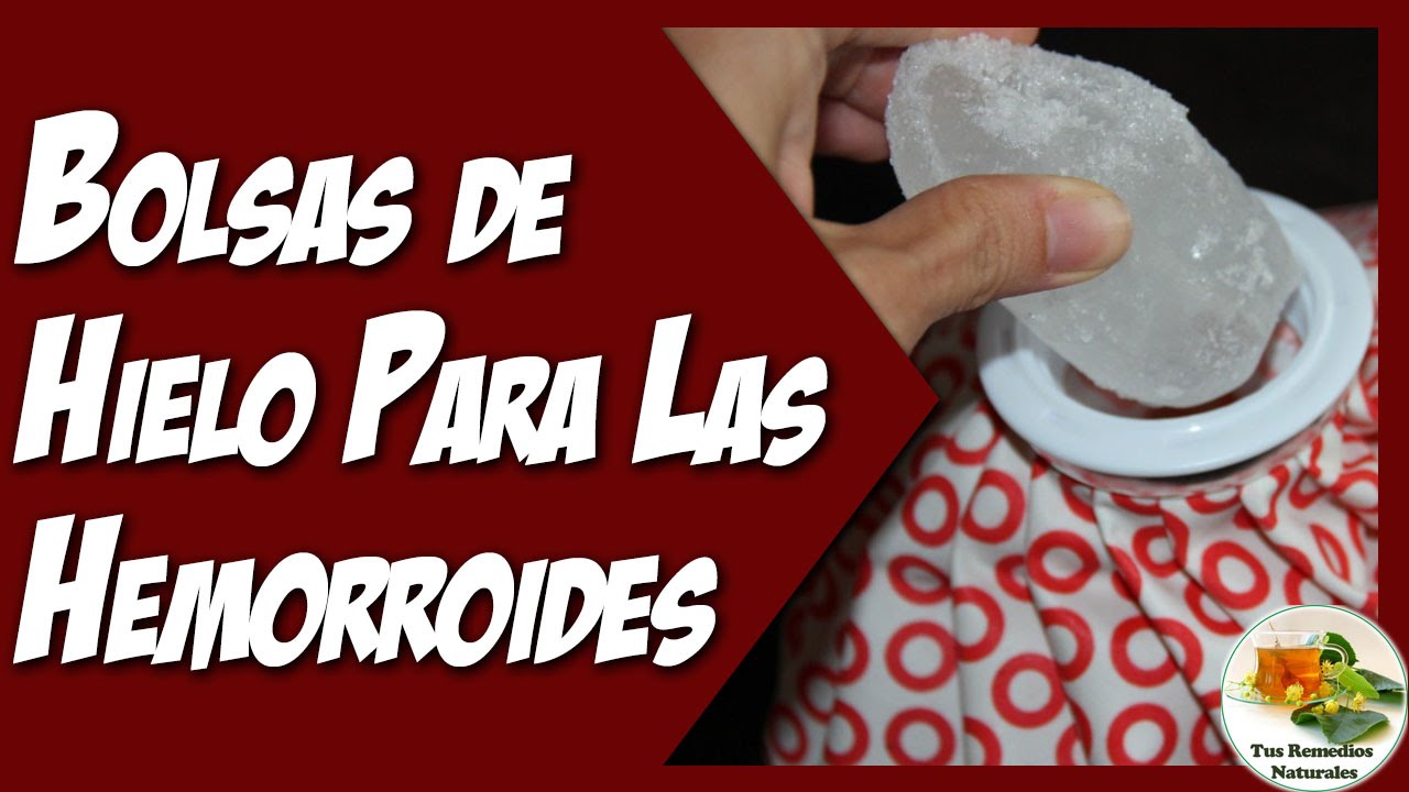 el hielo es bueno para las hemorroides