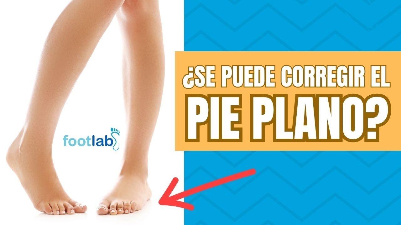 hasta que edad se puede corregir el pie plano