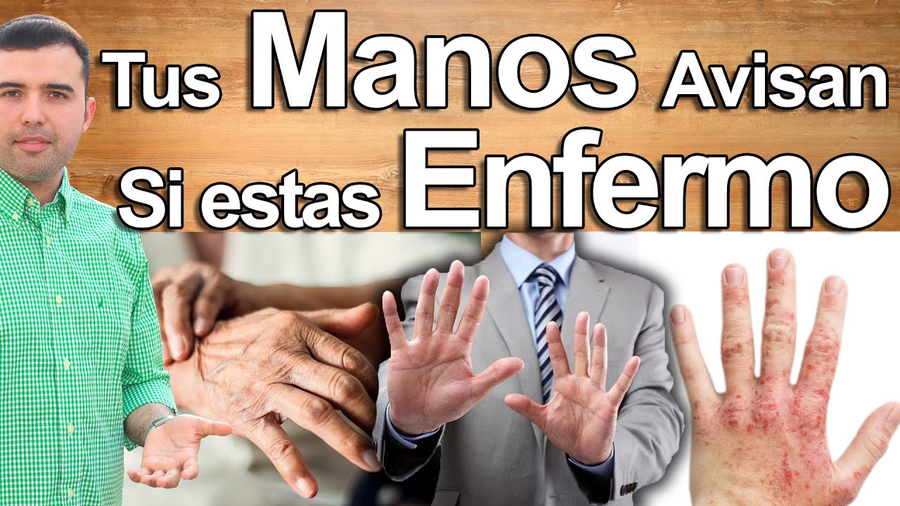 manchas en los dedos de las manos