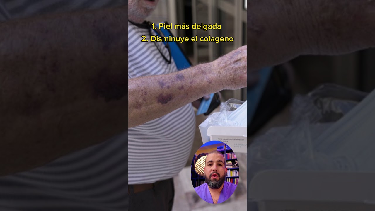 manchas rojas en la piel en ancianos