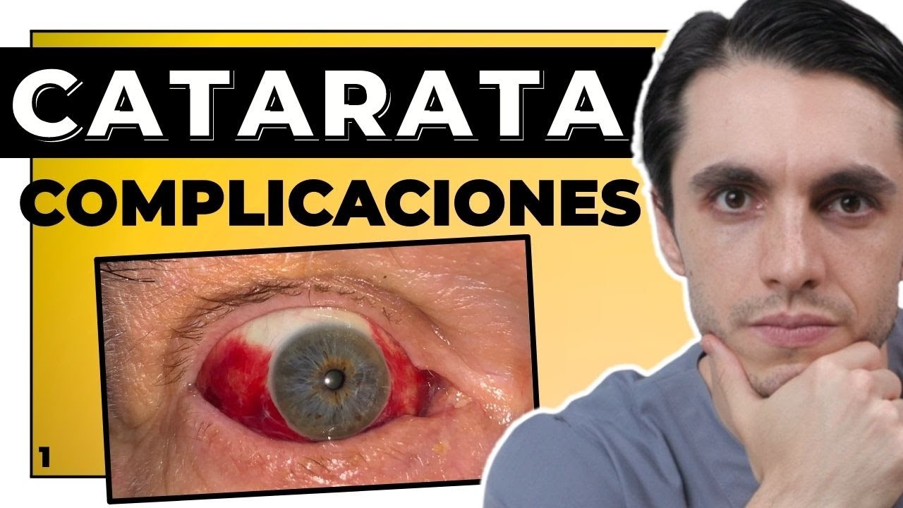 molestias en ojo operado de cataratas
