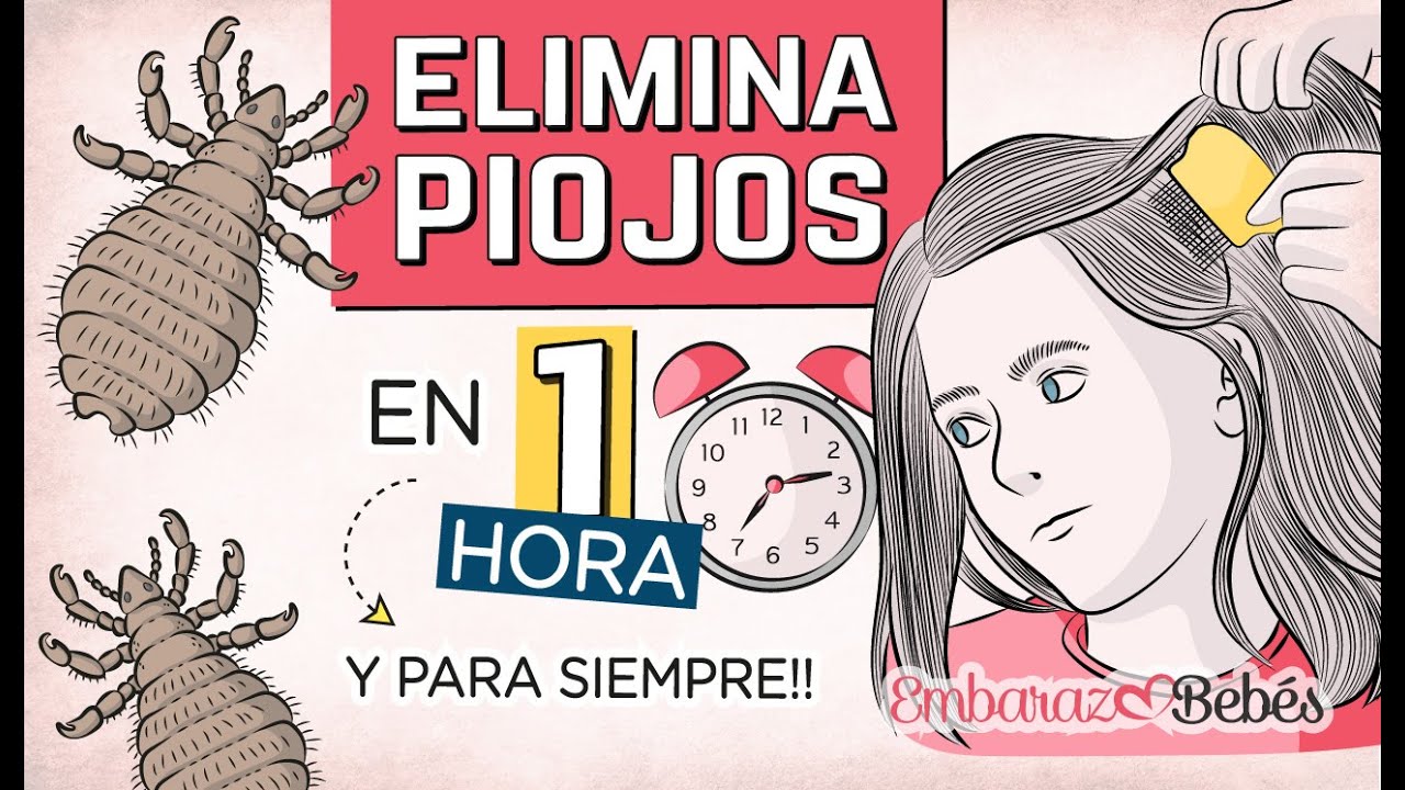 quitar piojos con vinagre y aceite de oliva