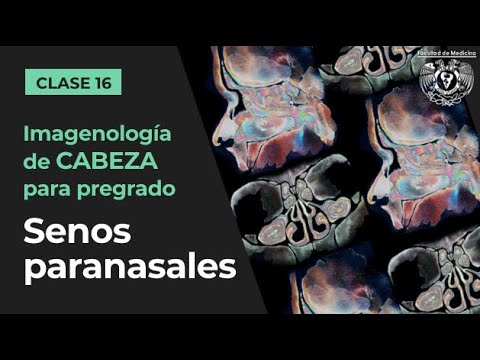 sinusitis radiografía de senos paranasales anormal