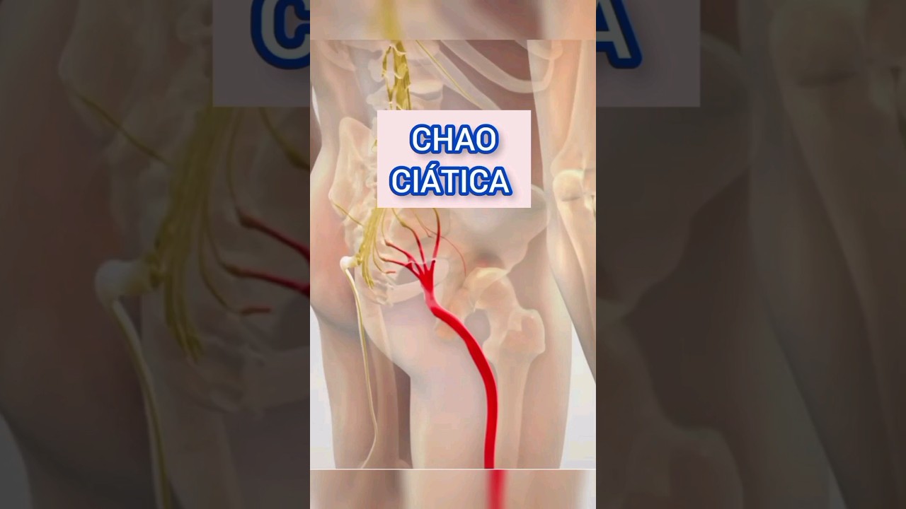 son buenas las corrientes para la ciática