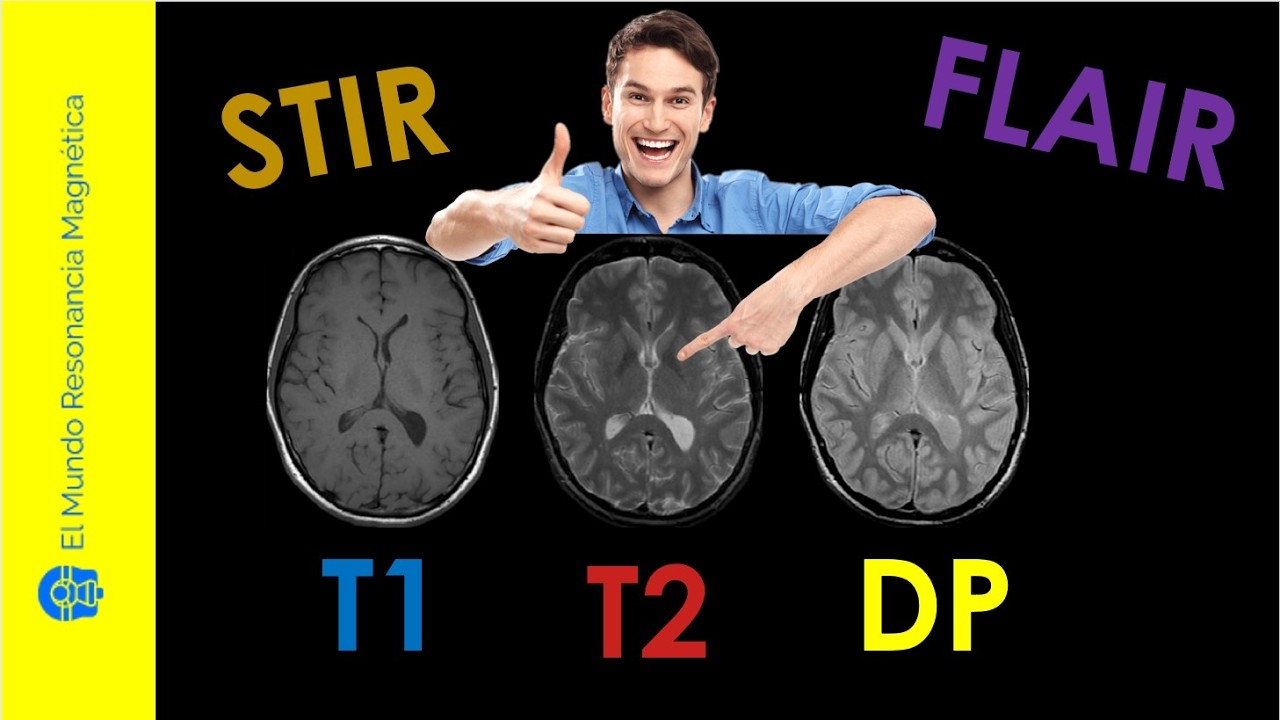 t1 y t2 en resonancia magnetica